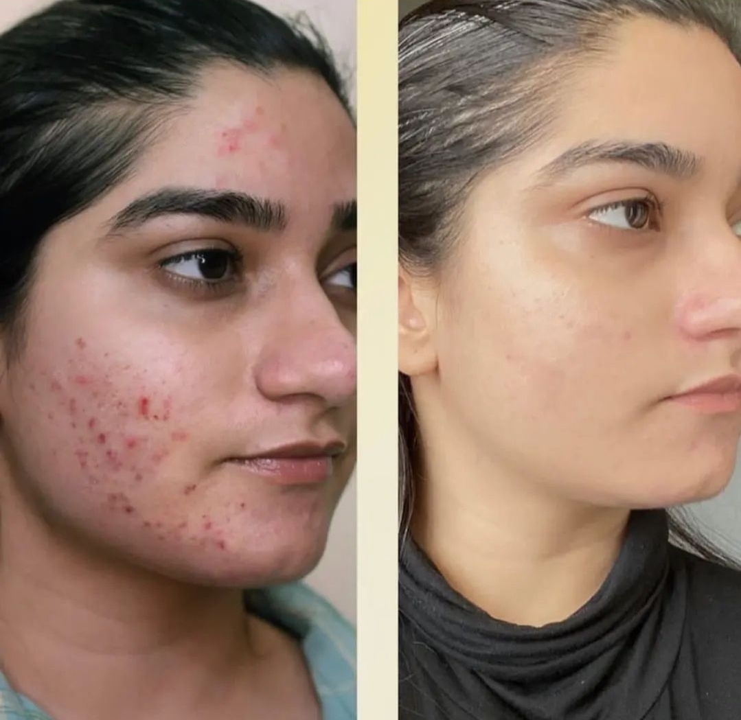 Screenshot_2024-09-21-09-24-06-27_1c337646f29875672b5a61192b9010f9