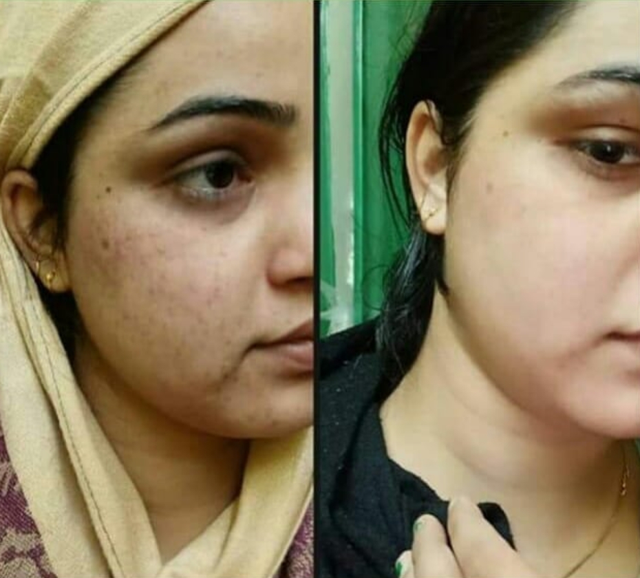 Screenshot_2025-01-15-01-38-27-84_1c337646f29875672b5a61192b9010f9